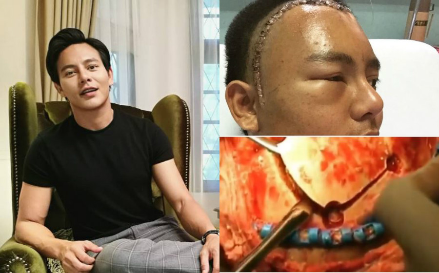 nazim-othman-video-bedah.jpg