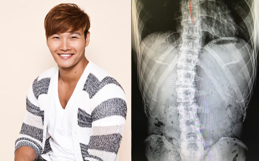 kim-joong-kok-xray.jpg