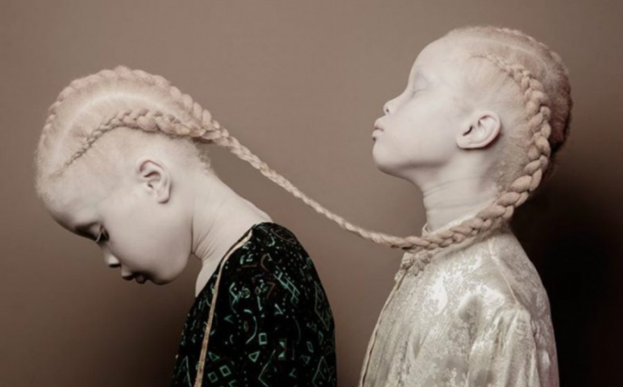 albino-header.jpg