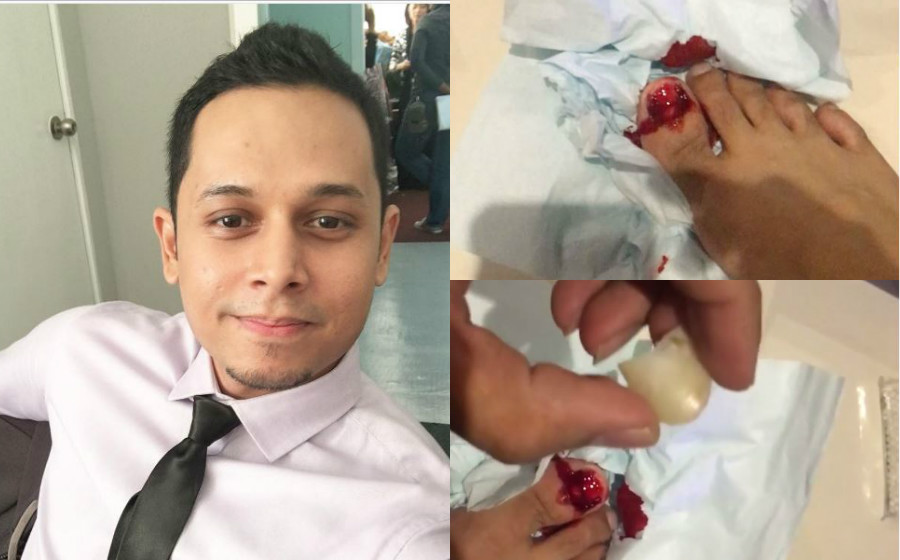 hafizul-kuku-tercabut.jpg