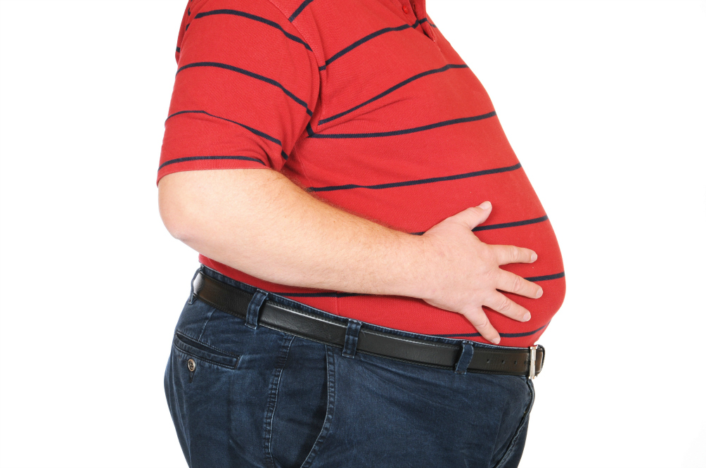 obese-(1).jpg