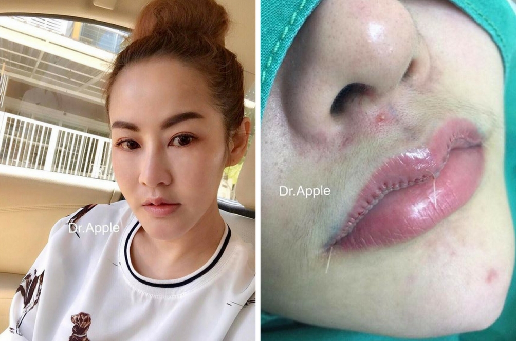 bibir5.jpg
