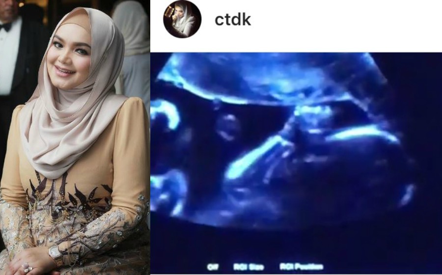 sitinurhalizaultrasound_1.jpg