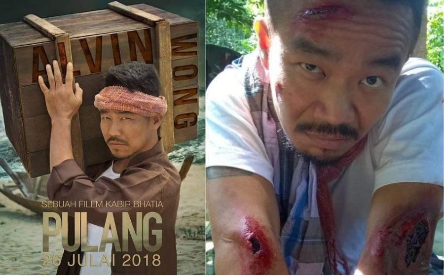 alvin-wong-ocd-header.jpg