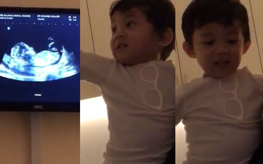 yusuf-iskandar-ultrasound.jpg