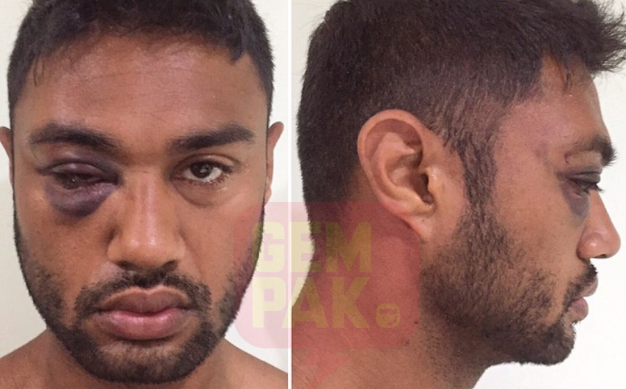 ammar-paskal-cedera-header.jpg