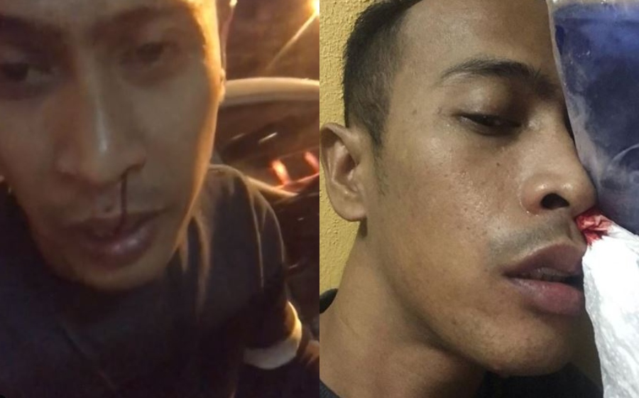 achey-hidung-darah.jpg