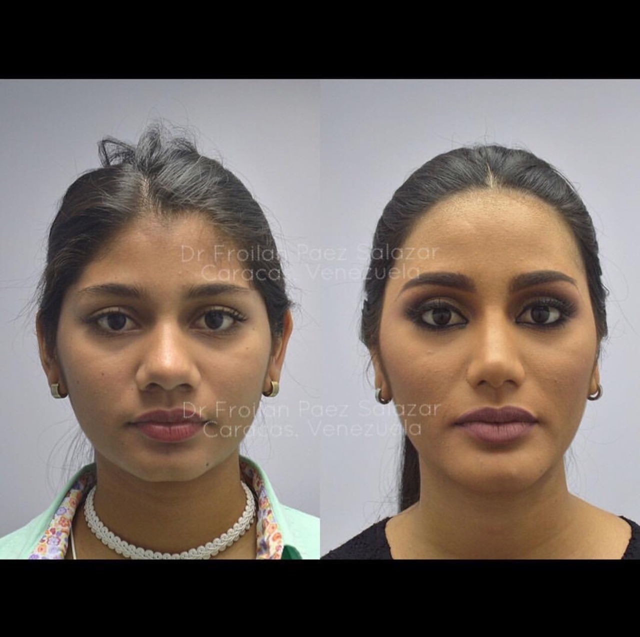 Gambar sebelum dan selepas.