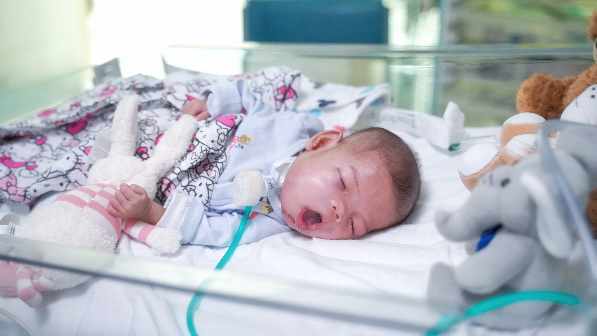 Baby Ainul a few weeks after her operation.