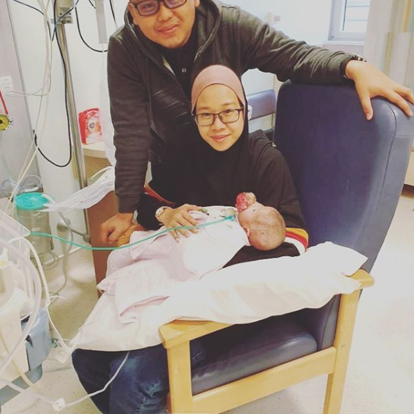 Baby Ainul and her parents before the surgery.
