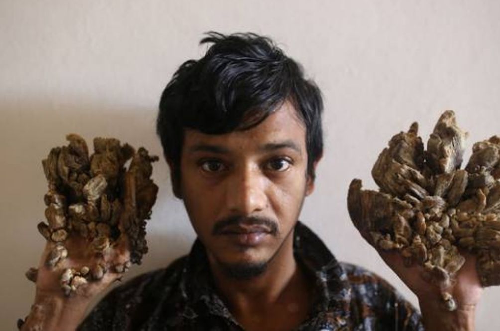 main-treeman.jpg