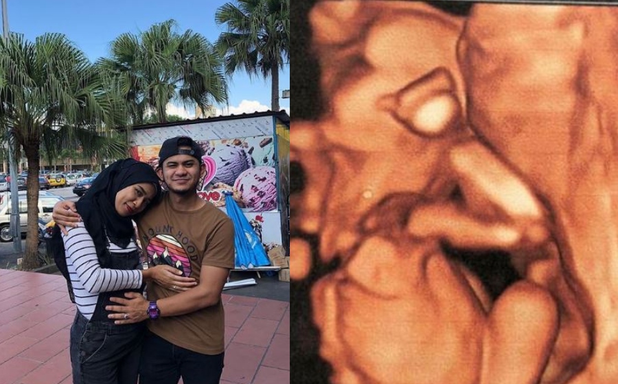 chot-isteri-hamil.jpg