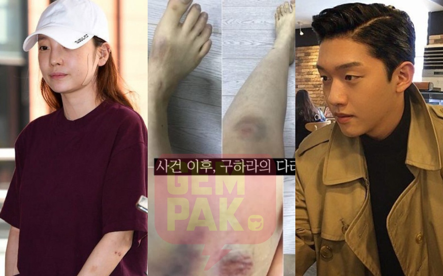 hara-kena-pukul-ex-boyfriend.jpg