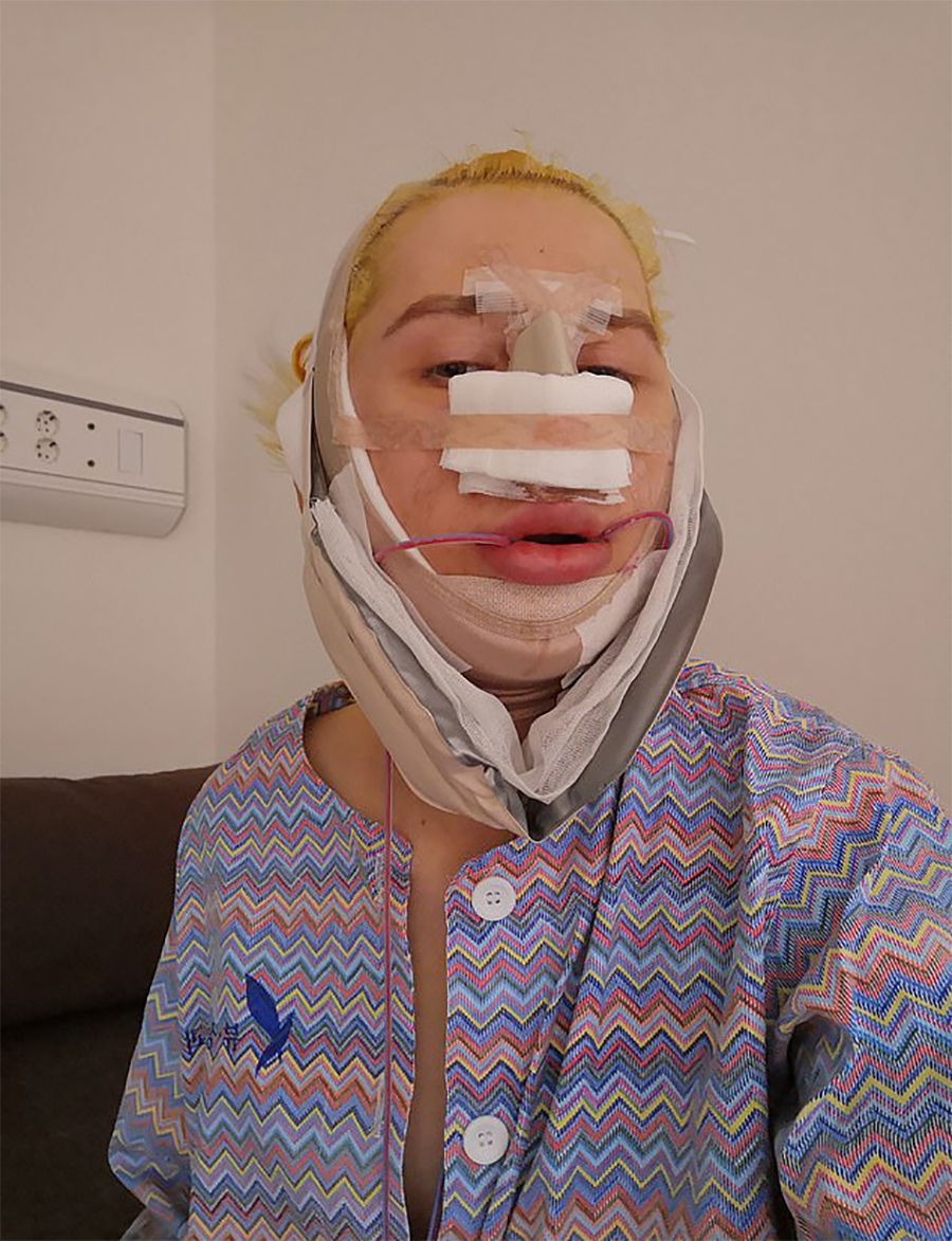 Many, many surgeries later.