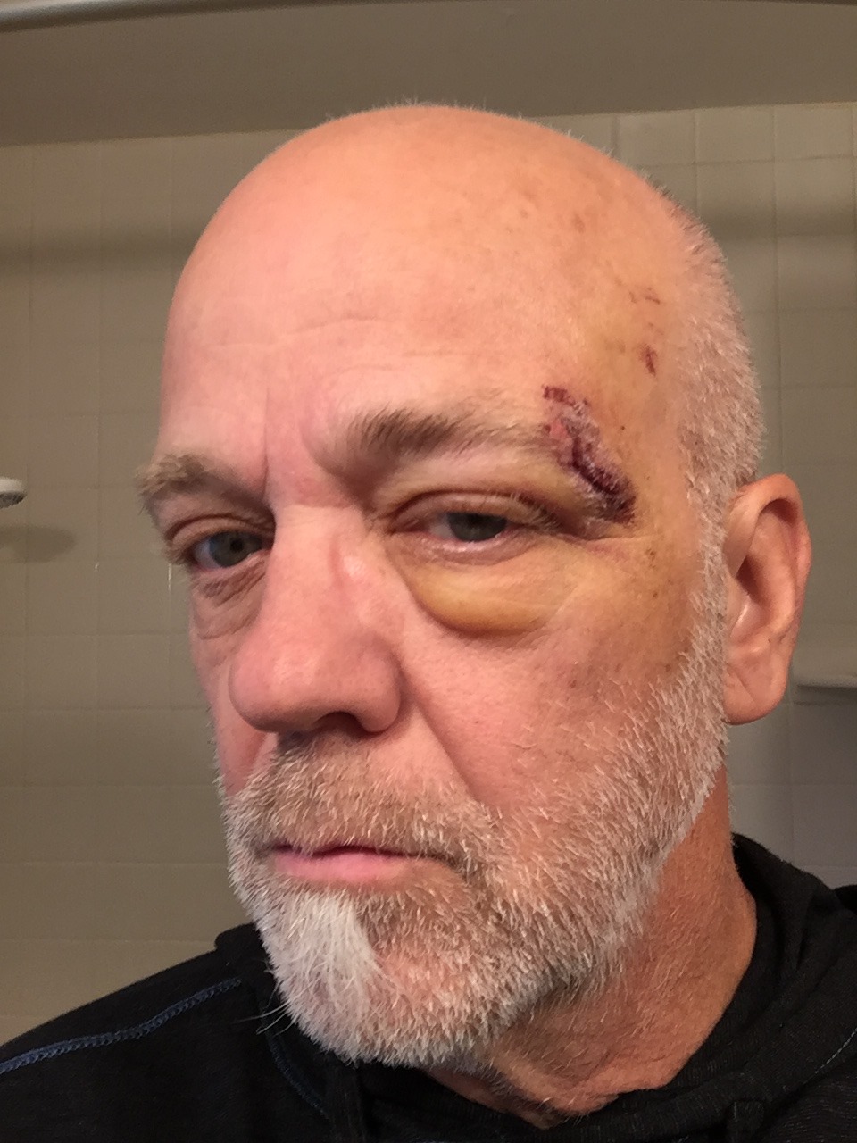 He's alive thanks to his Apple Watch.