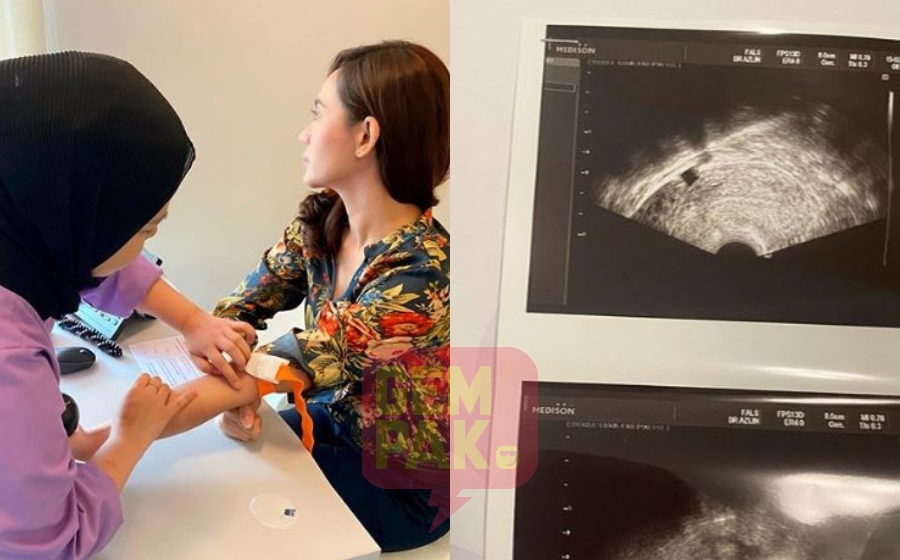 elizad-ivf_1.jpg