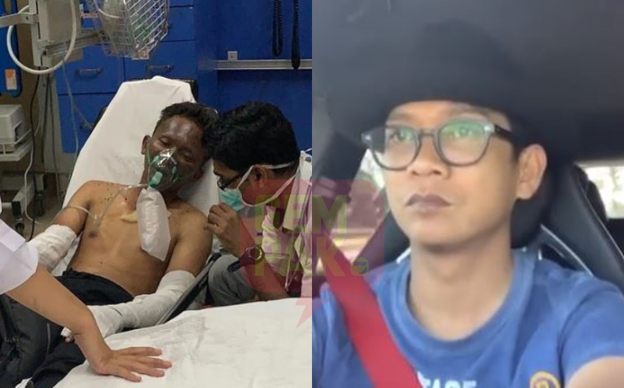 ajak-adik-terbakar.jpg