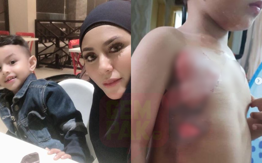iesya_tmelecur.jpg