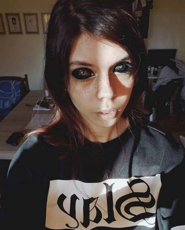 Now both her eyes are in trouble.
