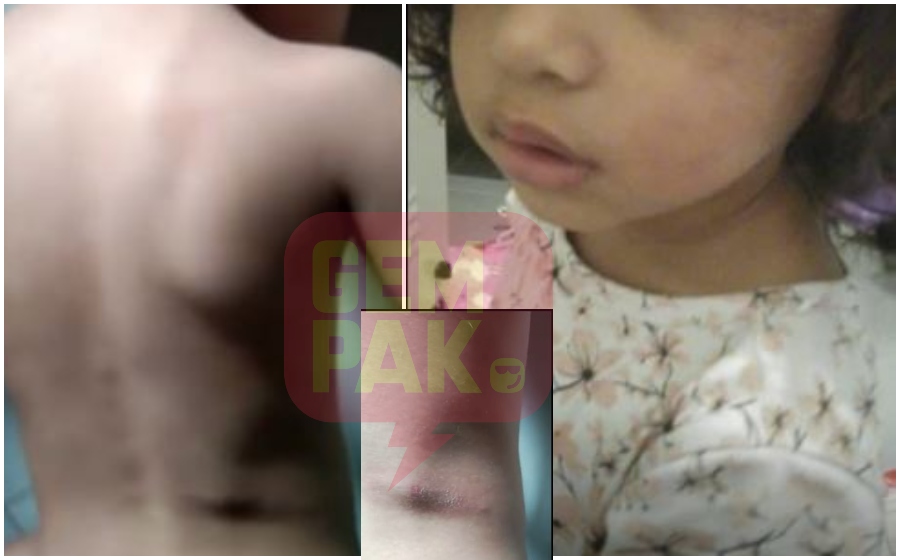 alif-syukri-pukul-anak-angkat.jpg