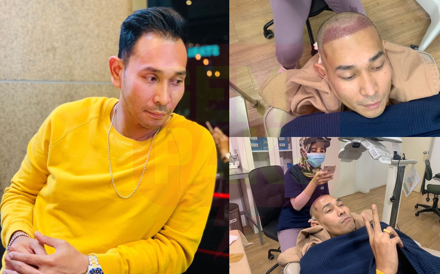 riz-tanam-rambut-header-(1).jpg