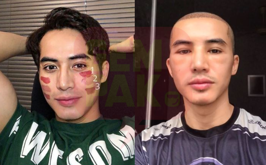 zoey-bengkak-header.jpg