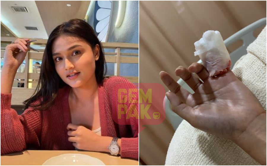 puteri-aishah-terpotong-jari2.jpg