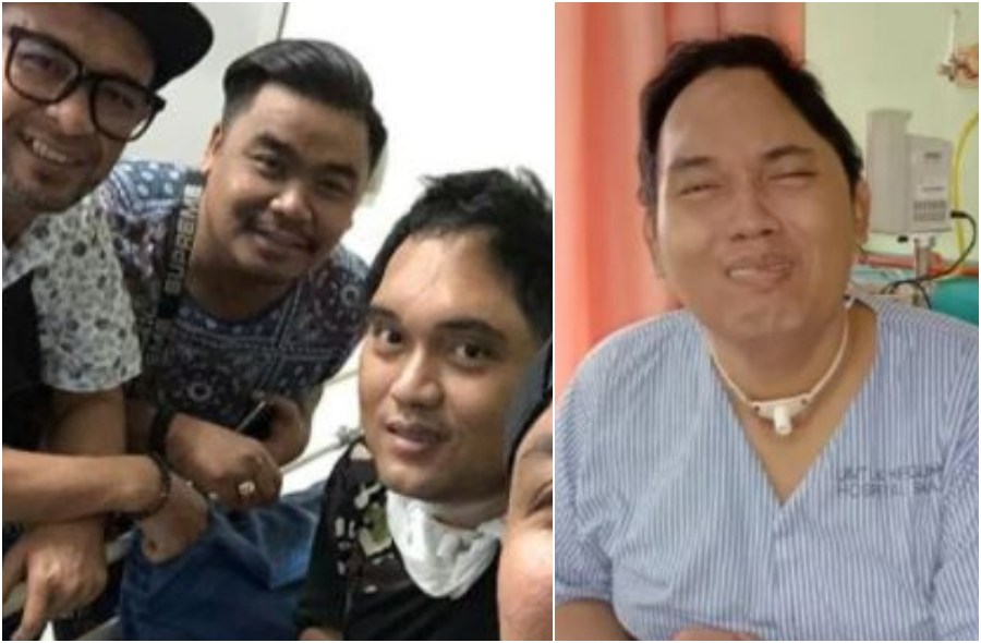 gbob-pasang-tempurung-kepala.jpg