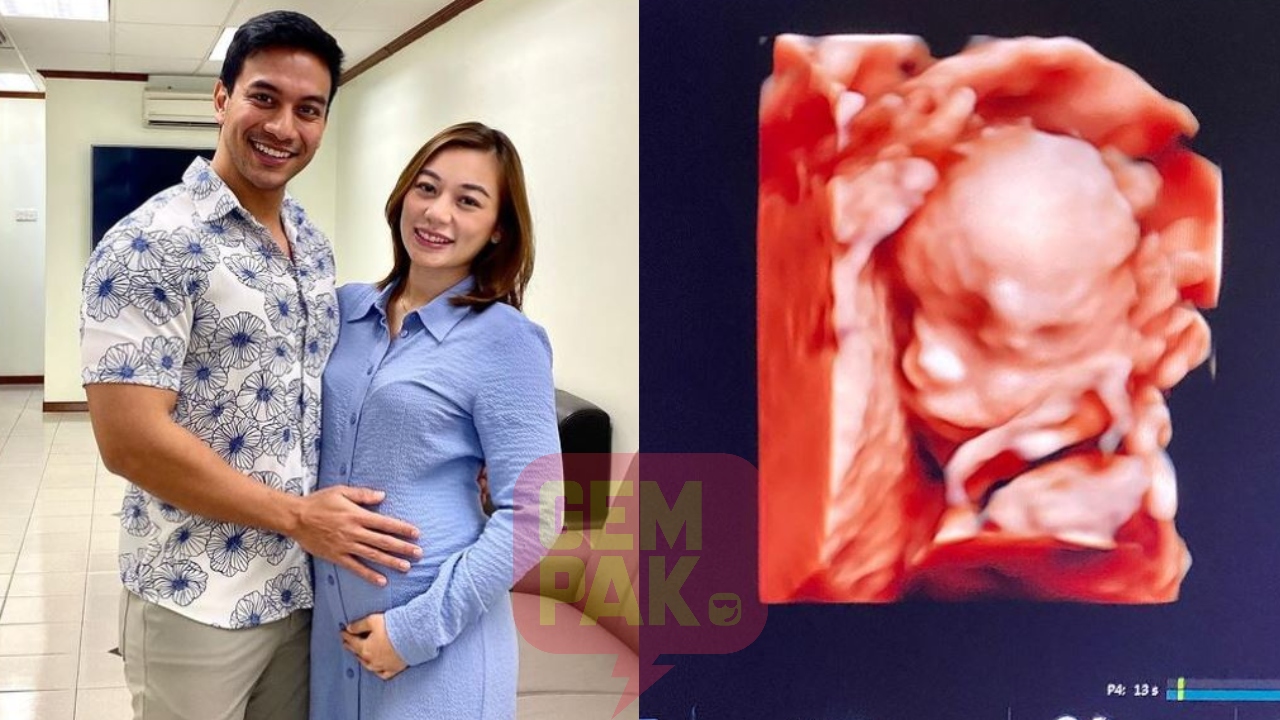 dr-say-isteri-hamil-kedua-gastrik-cepat-penat.jpg