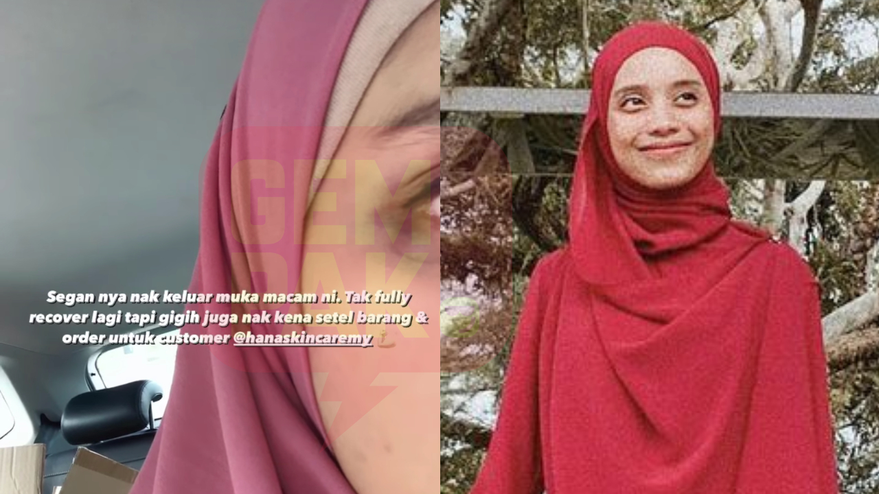 hana-lebam-header.jpg