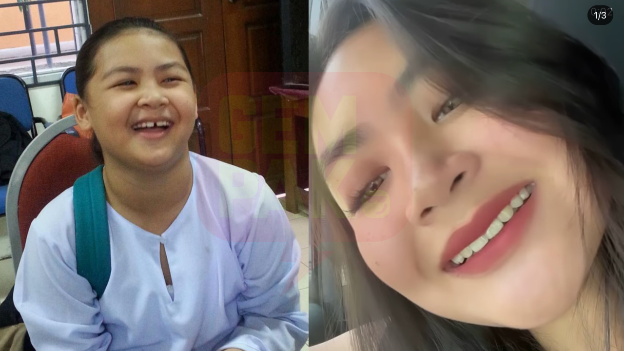 bella-braces-header.jpg