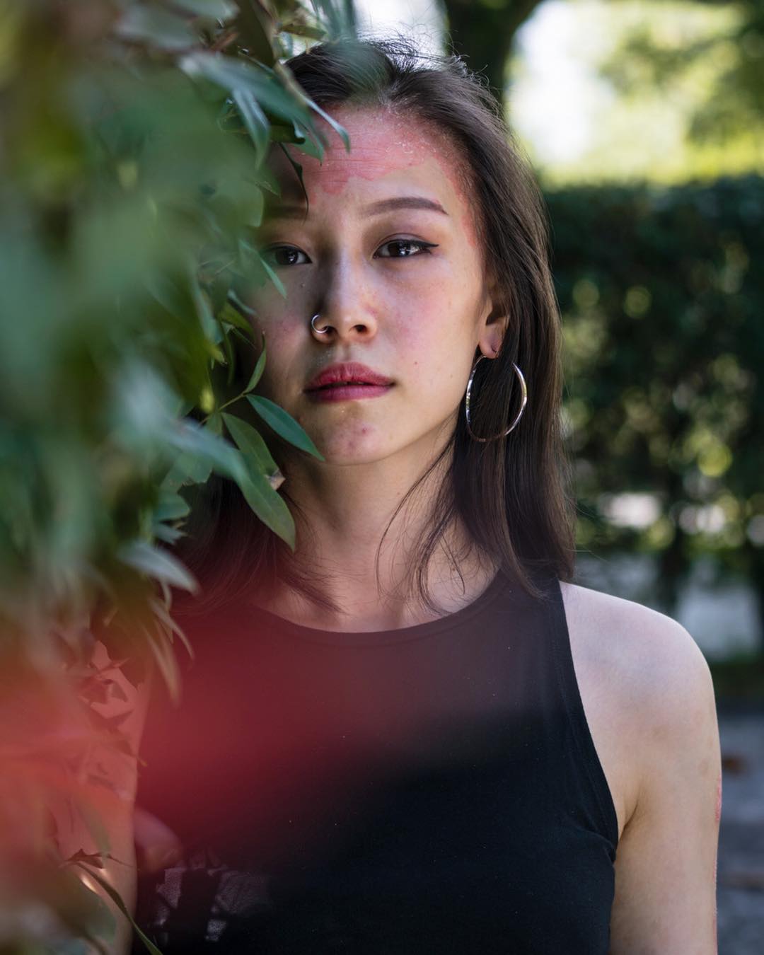 Instagram/rocyiewong Psoriasis brings another level of insecurity.