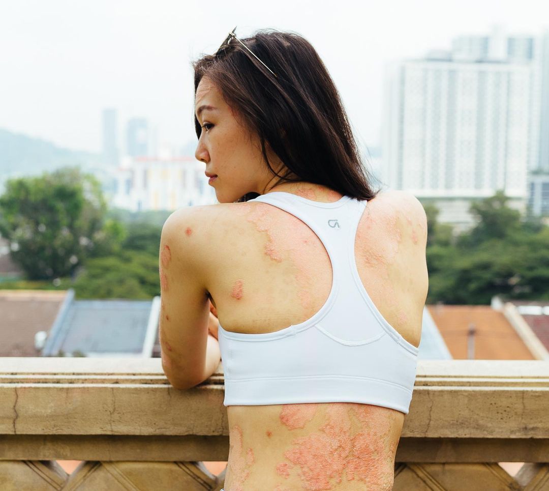 Instagram/rocyiewong Body insecurity is real.