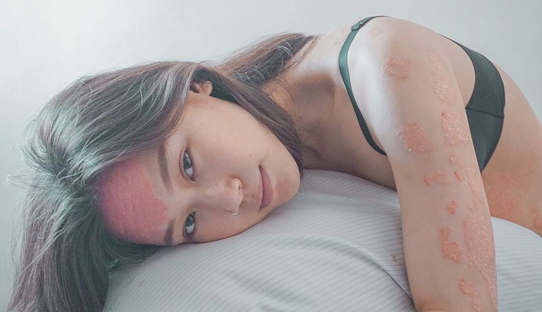Instagram/rocyiewong Rocyie had given so many treatments a shot.