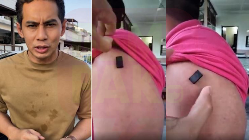 fizo-omar-magnet-melekat-lepas-vaksin.jpg