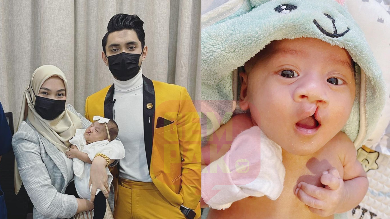 dika-sumbing-header.png