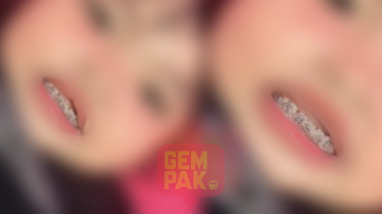 baby-pendakap-gigi.jpg