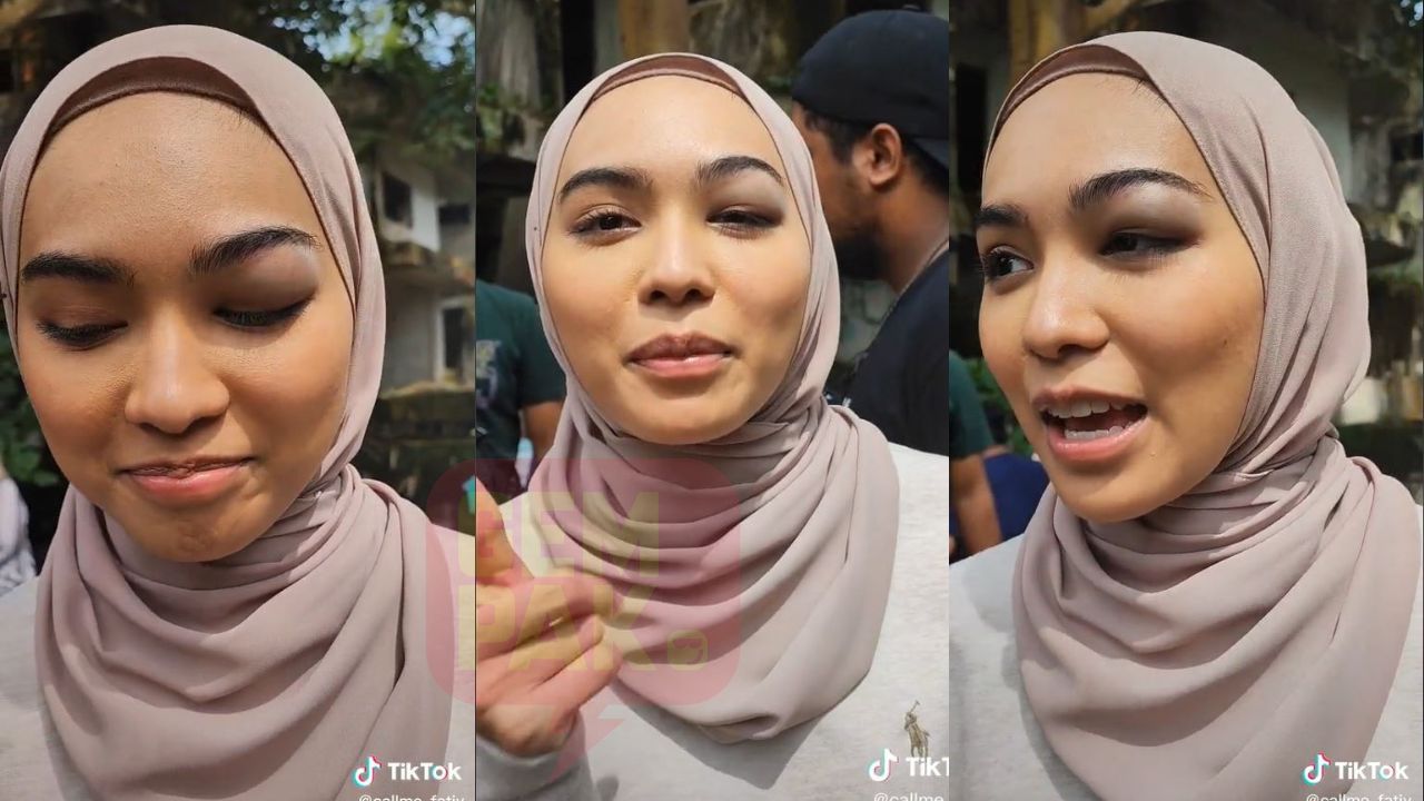 sharifah-rose-mata-bengkak.jpg
