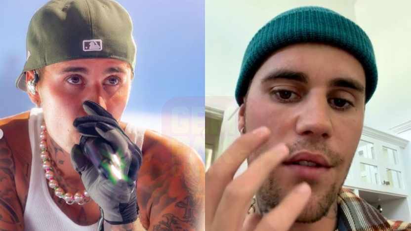 justinbieberlumpuh.jpg