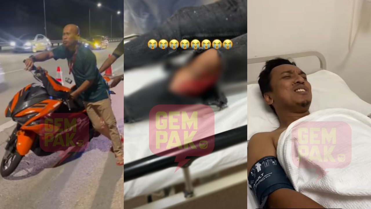 kena-monitor-under-hdu-ada-hentakan-dekat-kepala-isteri-maklum-fad-kemalangan-ramai-doa-cepat-sembuh.jpg