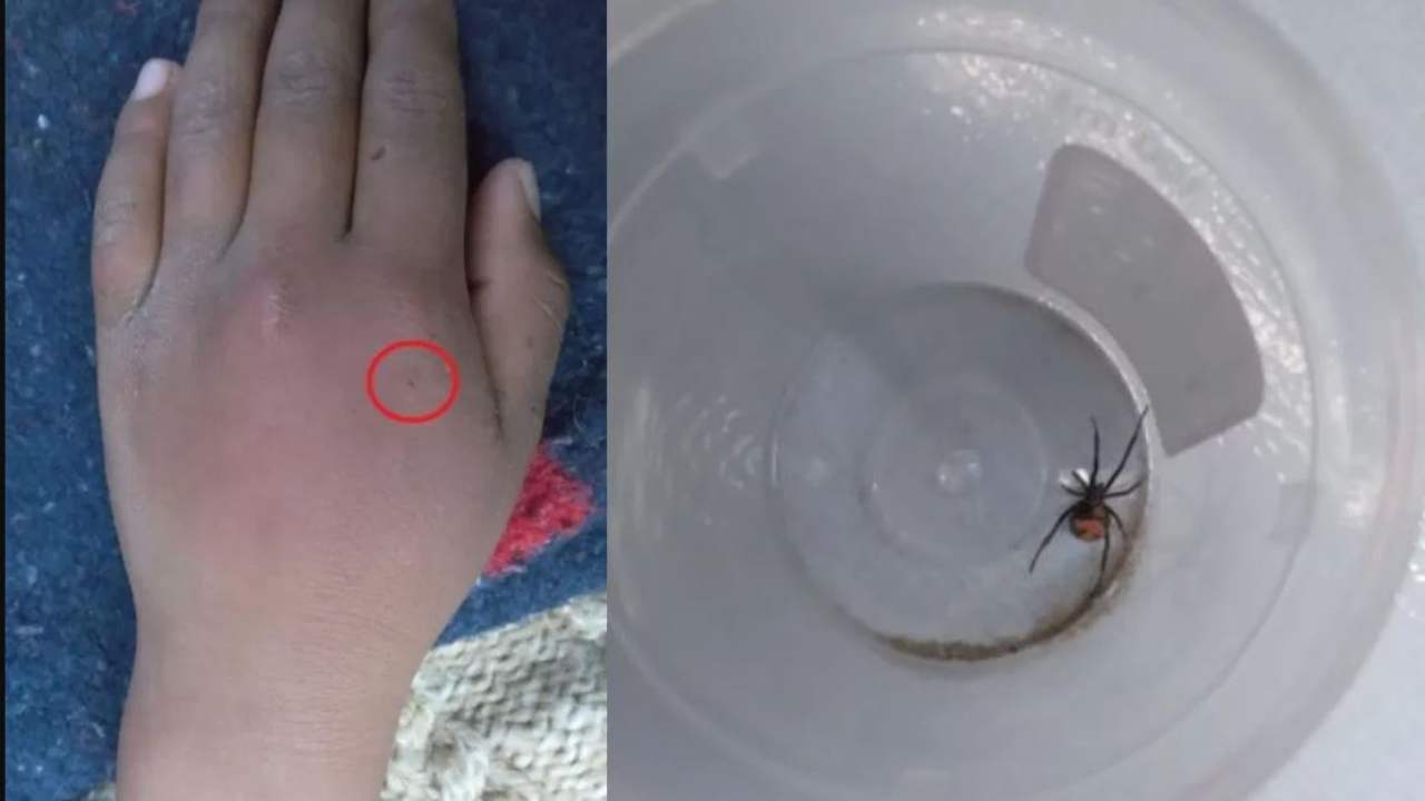 budak-lelaki-nak-jadi-spiderman-biar-diri-digigit-labah-labah-jenis-black-widow.jpg