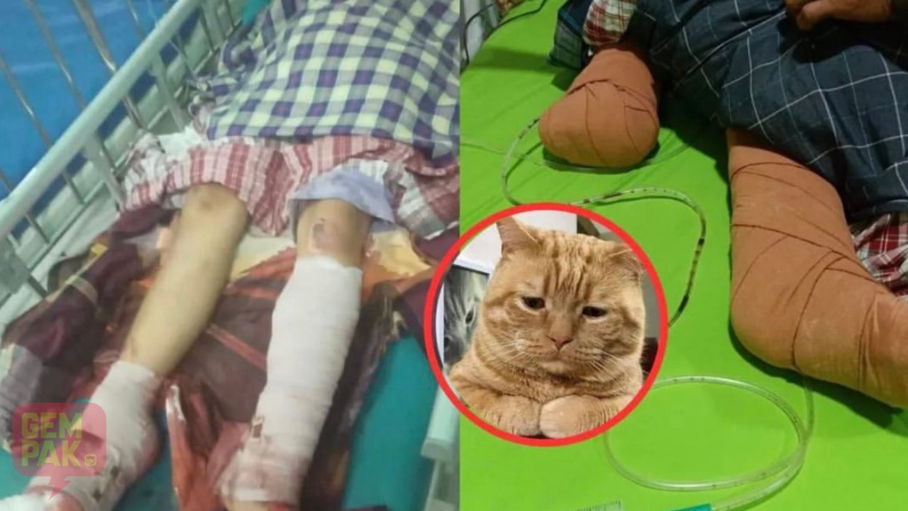 kaki-kanak-kanak-dipotong.jpg