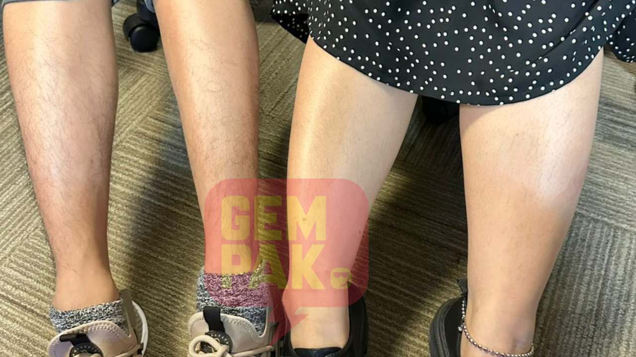 rasa-insecure-sebab-lebat-sangat-ini-lima-prosedur-boleh-hilangkan-bulu-kaki.jpg