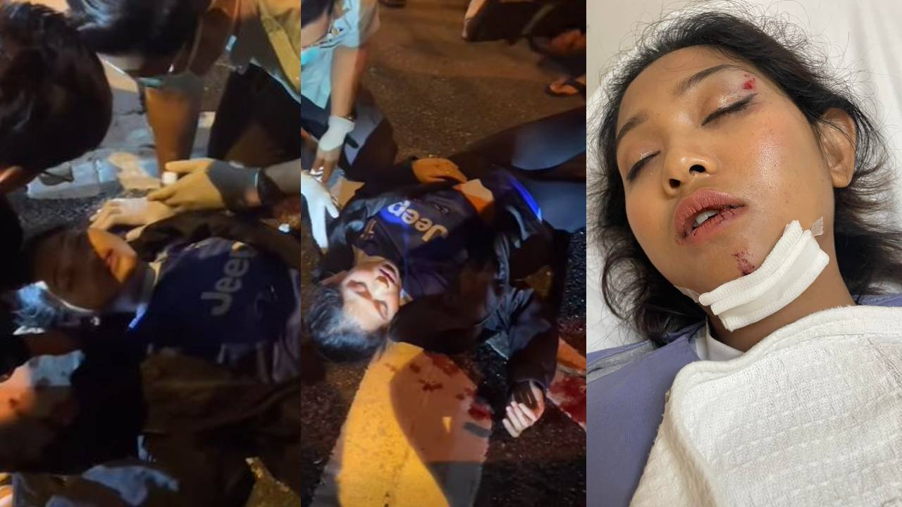 siti-jamumall-kemalangan-alami-patah-jari-tercampak-ke-jalan-raya-nasib-tak-digilis-kereta-lain.jpg