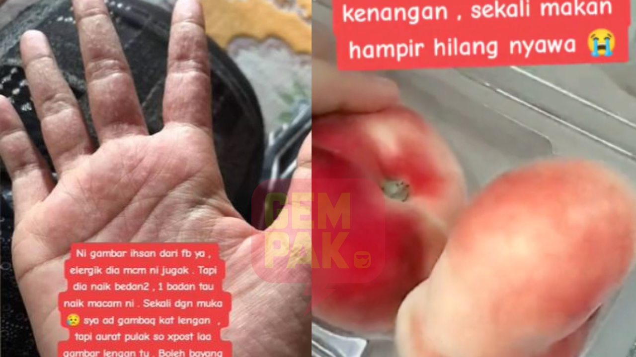 sebu-muntah-naik-biji-biji-gatal-wanita-hampir-hilang-nyawa-lepas-15-minit-makan-donut-peach.jpg