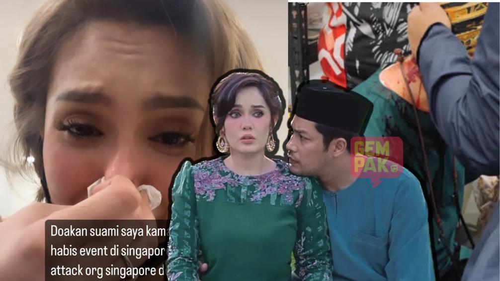dia-perlu-jalani-pembedahan-sekarang-kamal-adli-cedera-parah-diserang-di-singapura-uqasha-minta-doa-semua.jpeg