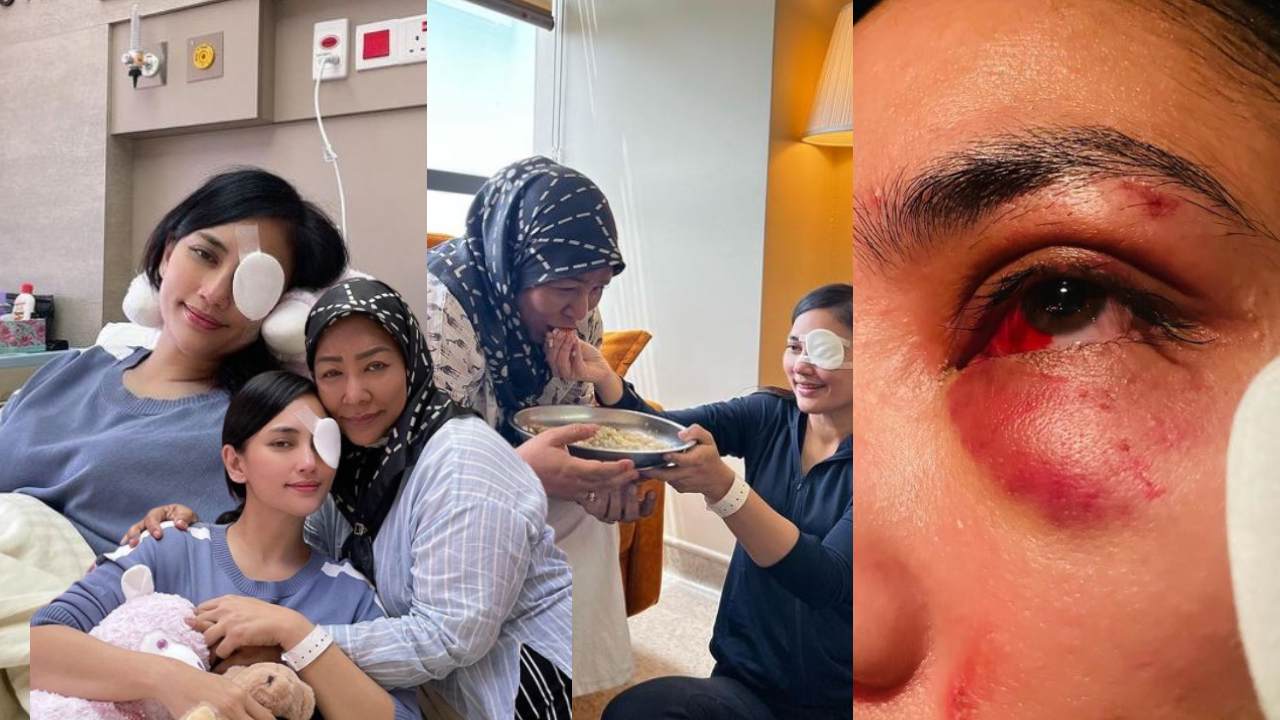 mungkin-kerana-kebaikan-doa-mama-allah-melindungi-mata-kanan-saya-fasha-sandha-syukur-dah-keluar-hospital.jpg