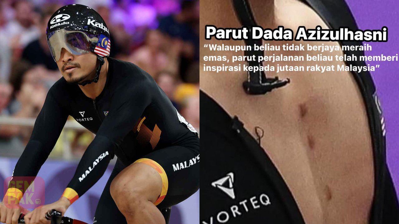 astro-gempak-parut-azizulhasni.jpg