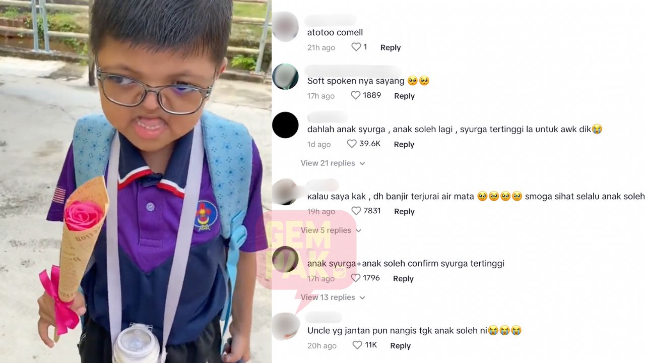 astro-gempak_netizen_sedih_anak_-sindrom_apert.jpg