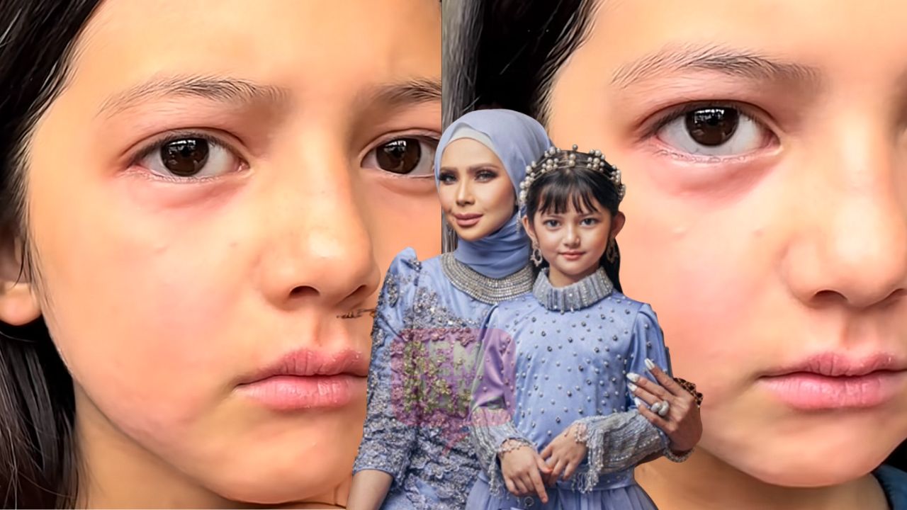astrogempak_anak-che-ta-allergic.jpg